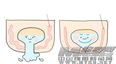 产后42天盆底检查你会按时做吗?